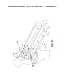 METHOD OF ASSEMBLING AND POSITIONING A FEMORAL ORTHOPAEDIC SURGICAL     INSTRUMENT diagram and image