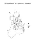 METHOD OF ASSEMBLING AND POSITIONING A FEMORAL ORTHOPAEDIC SURGICAL     INSTRUMENT diagram and image