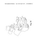 METHOD OF ASSEMBLING AND POSITIONING A FEMORAL ORTHOPAEDIC SURGICAL     INSTRUMENT diagram and image