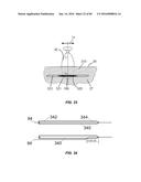 Blood Vessel Treatment with Pressure Shock Waves diagram and image