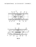 Blood Vessel Treatment with Pressure Shock Waves diagram and image