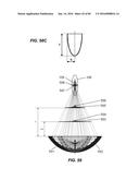 Blood Vessel Treatment with Pressure Shock Waves diagram and image