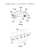 Blood Vessel Treatment with Pressure Shock Waves diagram and image