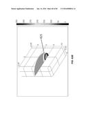 Blood Vessel Treatment with Pressure Shock Waves diagram and image