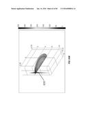 Blood Vessel Treatment with Pressure Shock Waves diagram and image