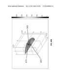 Blood Vessel Treatment with Pressure Shock Waves diagram and image