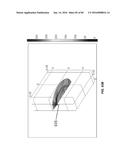 Blood Vessel Treatment with Pressure Shock Waves diagram and image