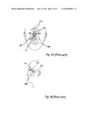 DEVICES, SYSTEMS AND METHODS FOR DIAGNOSING AND TREATING SINUSITIS AND     OTHER DISORDERS OF THE EARS, NOSE, AND/OR THROAT diagram and image