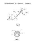 DEVICES, SYSTEMS AND METHODS FOR DIAGNOSING AND TREATING SINUSITIS AND     OTHER DISORDERS OF THE EARS, NOSE, AND/OR THROAT diagram and image