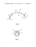 DEVICES, SYSTEMS AND METHODS FOR DIAGNOSING AND TREATING SINUSITIS AND     OTHER DISORDERS OF THE EARS, NOSE, AND/OR THROAT diagram and image