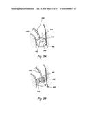 DEVICES, SYSTEMS AND METHODS FOR DIAGNOSING AND TREATING SINUSITIS AND     OTHER DISORDERS OF THE EARS, NOSE, AND/OR THROAT diagram and image