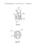 DEVICES, SYSTEMS AND METHODS FOR DIAGNOSING AND TREATING SINUSITIS AND     OTHER DISORDERS OF THE EARS, NOSE, AND/OR THROAT diagram and image