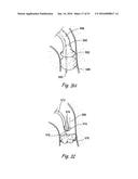 DEVICES, SYSTEMS AND METHODS FOR DIAGNOSING AND TREATING SINUSITIS AND     OTHER DISORDERS OF THE EARS, NOSE, AND/OR THROAT diagram and image