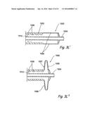 DEVICES, SYSTEMS AND METHODS FOR DIAGNOSING AND TREATING SINUSITIS AND     OTHER DISORDERS OF THE EARS, NOSE, AND/OR THROAT diagram and image