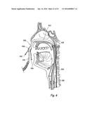 DEVICES, SYSTEMS AND METHODS FOR DIAGNOSING AND TREATING SINUSITIS AND     OTHER DISORDERS OF THE EARS, NOSE, AND/OR THROAT diagram and image