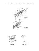 DEVICES, SYSTEMS AND METHODS FOR DIAGNOSING AND TREATING SINUSITIS AND     OTHER DISORDERS OF THE EARS, NOSE, AND/OR THROAT diagram and image