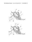 DEVICES, SYSTEMS AND METHODS FOR DIAGNOSING AND TREATING SINUSITIS AND     OTHER DISORDERS OF THE EARS, NOSE, AND/OR THROAT diagram and image