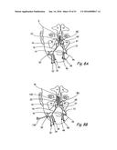 DEVICES, SYSTEMS AND METHODS FOR DIAGNOSING AND TREATING SINUSITIS AND     OTHER DISORDERS OF THE EARS, NOSE, AND/OR THROAT diagram and image