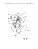 DEVICES, SYSTEMS AND METHODS FOR DIAGNOSING AND TREATING SINUSITIS AND     OTHER DISORDERS OF THE EARS, NOSE, AND/OR THROAT diagram and image