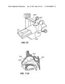 DEVICES, SYSTEMS AND METHODS FOR DIAGNOSING AND TREATING SINUSITIS AND     OTHER DISORDERS OF THE EARS, NOSE, AND/OR THROAT diagram and image