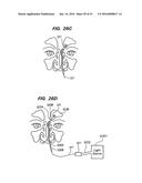 DEVICES, SYSTEMS AND METHODS FOR DIAGNOSING AND TREATING SINUSITIS AND     OTHER DISORDERS OF THE EARS, NOSE, AND/OR THROAT diagram and image