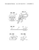 DEVICES, SYSTEMS AND METHODS FOR DIAGNOSING AND TREATING SINUSITIS AND     OTHER DISORDERS OF THE EARS, NOSE, AND/OR THROAT diagram and image