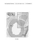 RENAL DENERVATION WITH STAGED ASSESSMENT diagram and image