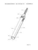 MINIMALLY INVASIVE PEDICLE SCREW EXTENSION SLEEVE SYSTEM diagram and image