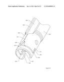 MINIMALLY INVASIVE PEDICLE SCREW EXTENSION SLEEVE SYSTEM diagram and image