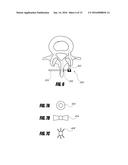 MEDICAL DEVICE AND METHOD TO CORRECT DEFORMITY diagram and image