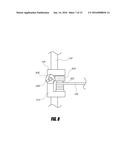 MEDICAL DEVICE AND METHOD TO CORRECT DEFORMITY diagram and image