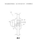 MEDICAL DEVICE AND METHOD TO CORRECT DEFORMITY diagram and image