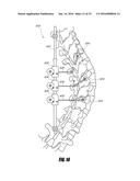 MEDICAL DEVICE AND METHOD TO CORRECT DEFORMITY diagram and image