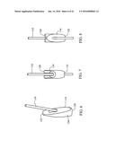 TISSUE FIXATION SYSTEM AND METHOD diagram and image