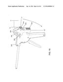 TISSUE FIXATION SYSTEM AND METHOD diagram and image