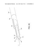 TISSUE FIXATION SYSTEM AND METHOD diagram and image