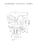 TISSUE FIXATION SYSTEM AND METHOD diagram and image