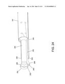 TISSUE FIXATION SYSTEM AND METHOD diagram and image