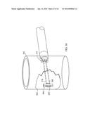 TISSUE FIXATION SYSTEM AND METHOD diagram and image