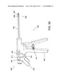 TISSUE FIXATION SYSTEM AND METHOD diagram and image