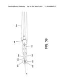 TISSUE FIXATION SYSTEM AND METHOD diagram and image