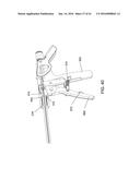 TISSUE FIXATION SYSTEM AND METHOD diagram and image