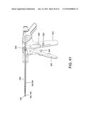 TISSUE FIXATION SYSTEM AND METHOD diagram and image