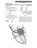 APPARATUS AND METHOD FOR INTRA-CARDIAC MAPPING AND ABLATION diagram and image