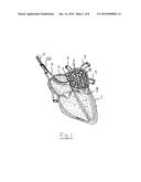 APPARATUS AND METHOD FOR INTRA-CARDIAC MAPPING AND ABLATION diagram and image