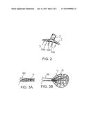 APPARATUS AND METHOD FOR INTRA-CARDIAC MAPPING AND ABLATION diagram and image