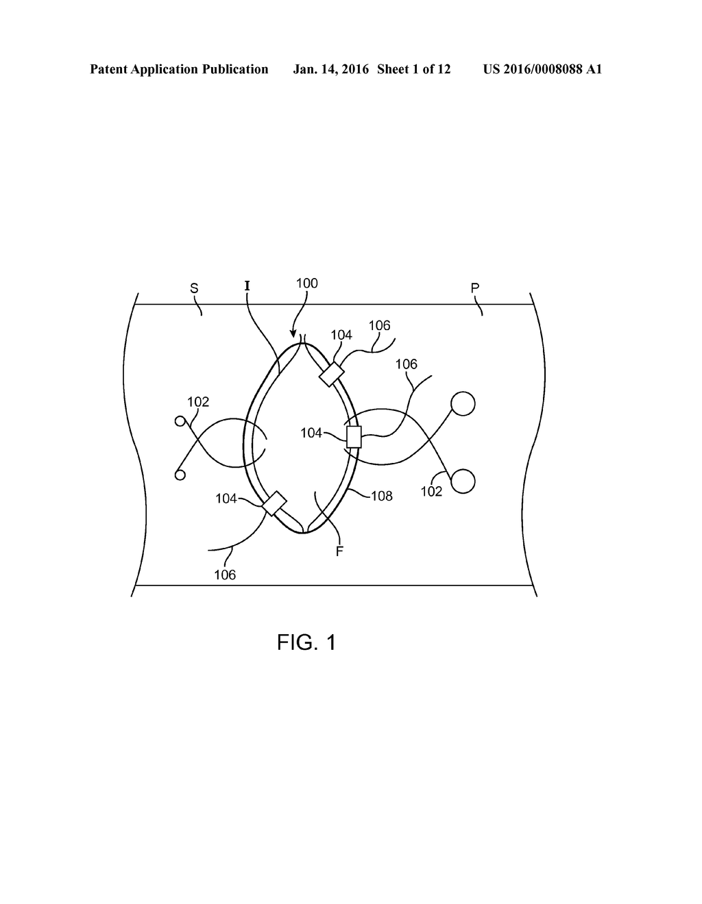 DROP IN SURGICAL ILLUMINATOR - diagram, schematic, and image 02