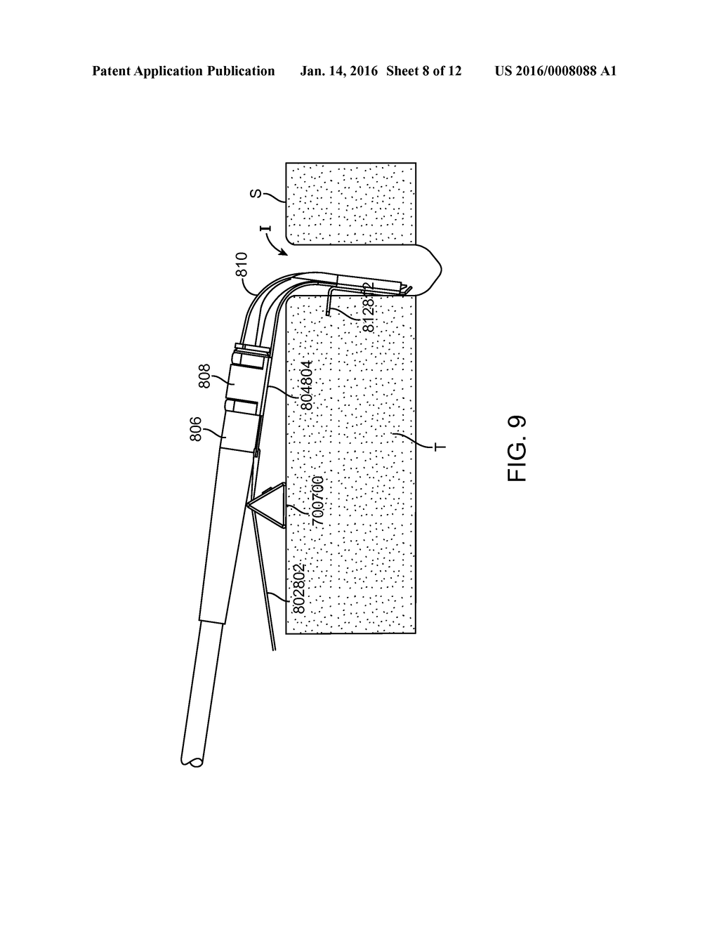 DROP IN SURGICAL ILLUMINATOR - diagram, schematic, and image 09