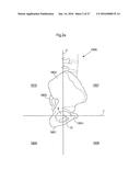 HIP JOINT DEVICE AND METHOD diagram and image