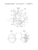 HIP JOINT DEVICE AND METHOD diagram and image